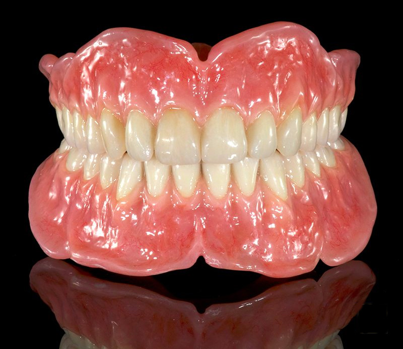 Hi Impact  Special Denture